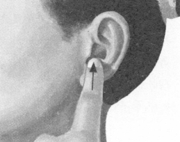 腰椎间盘突出症按摩部位图解