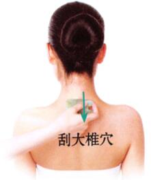 腰背酸痛刮痧部位图解