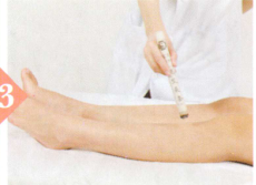 血栓闭塞性脉管炎艾灸哪个部位图解