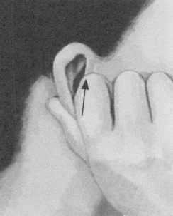 痛经按摩部位图解