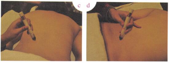 关节疼痛艾灸哪个部位图解