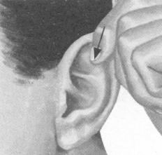 风湿病按摩部位图解