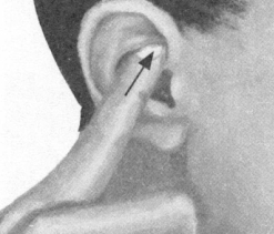 风湿病按摩部位图解