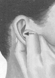 肥胖症按摩部位图解