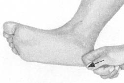 腰椎间盘突出症按摩部位图解