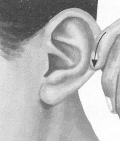 风湿病按摩部位图解