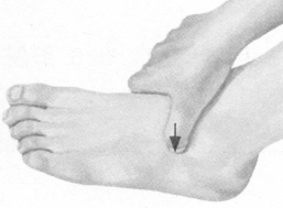 风湿病按摩部位图解