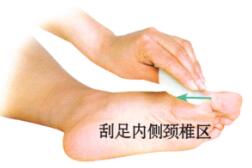 颈椎病刮痧部位图解