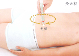 小儿腹泻艾灸哪个部位图解