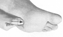 高血压按摩部位图解