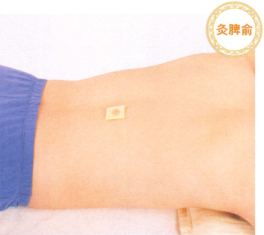 腹泻艾灸哪个部位图解