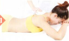 皮肤瘙痒拔罐部位图解