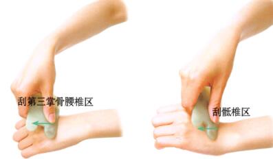 腰椎间盘突出刮痧部位图解