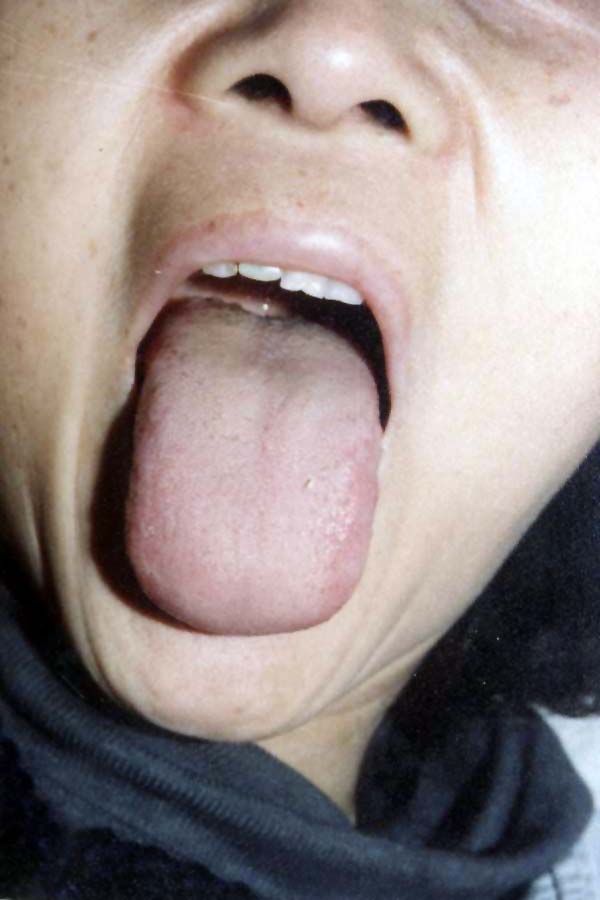 中医望色之面色白，舌色淡红