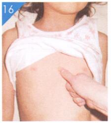 小儿积滞按摩部位图解