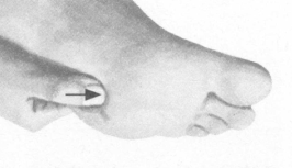 失眠症按摩部位图解