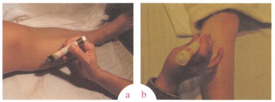 中风艾灸哪个部位图解