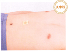 痢疾艾灸哪个部位图解