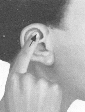 肩周炎按摩部位图解