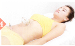 胃痉挛拔罐部位图解