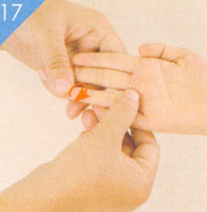 小儿麻疹按摩部位图解