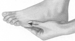 颈椎病按摩部位图解