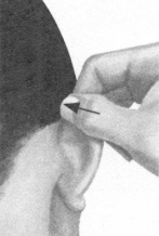 高脂血症按摩部位图解