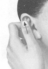 颈椎病按摩部位图解