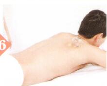 胸闷拔罐部位图解