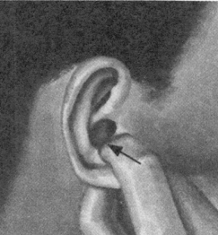 耳鸣-耳痛按摩部位图解