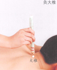 鼻出血艾灸哪个部位图解