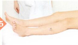 梅尼埃综合征拔罐部位图解