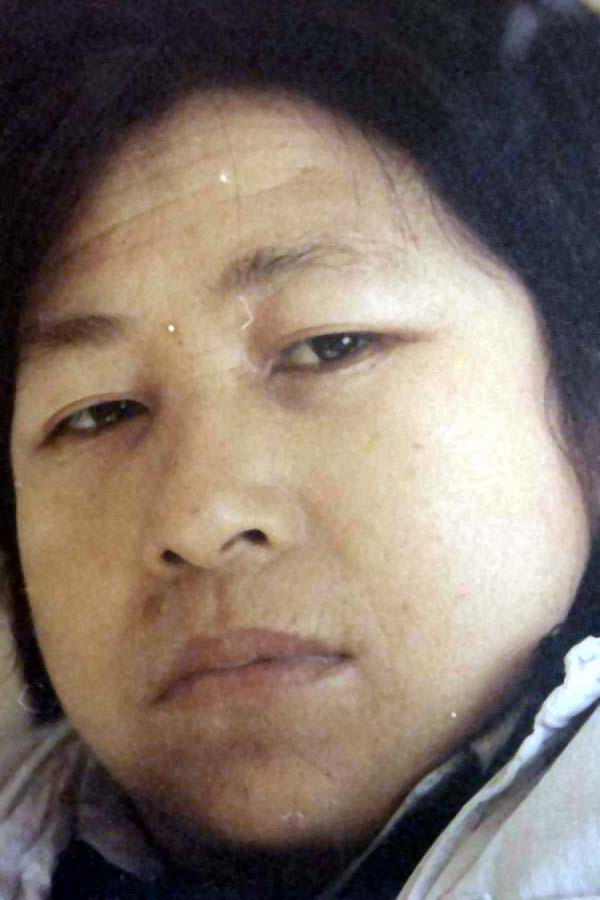 中医望色之面黄虚浮