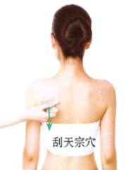 急性乳腺炎刮痧部位图解