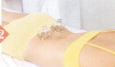 痔疮拔罐部位图解