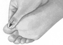 颈椎病按摩部位图解