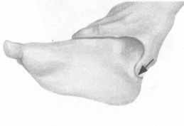 腰痛按摩部位图解