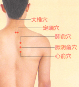 慢性支气管炎艾灸哪个部位图解