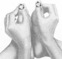 糖尿病按摩部位图解