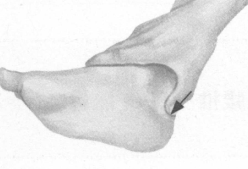 颈背痛按摩部位图解