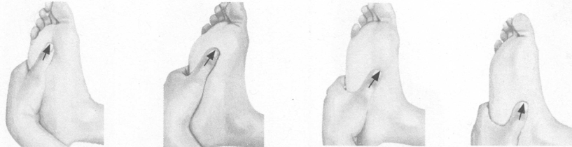 早泄按摩部位图解