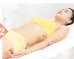 中风后遗症拔罐部位图解