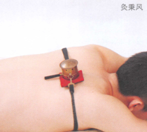 肩周炎艾灸哪个部位图解