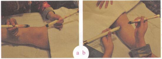 关节疼痛艾灸哪个部位图解