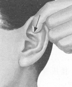 风湿病按摩部位图解