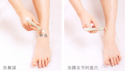踝关节扭伤艾灸哪个部位图解