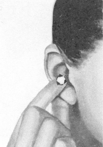 腰椎间盘突出症按摩部位图解