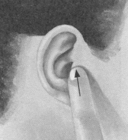 鼻炎按摩部位图解