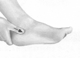 慢性盆腔炎按摩部位图解