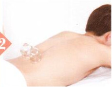 不育症拔罐部位图解